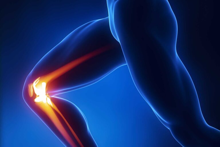 10 Of The Best Exercises For Knee Pain And To Help Strengthen Knees F