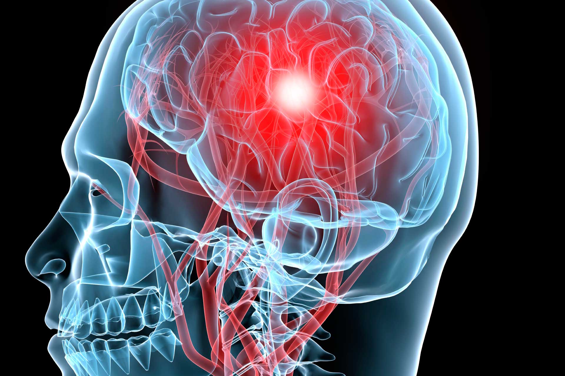 A Little Exercise Helps Improve Blood Flow To The Brain F