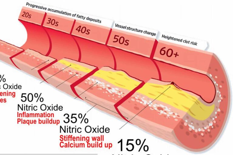 Nitric Oxide Infographic F