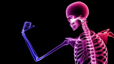 Bone Health
