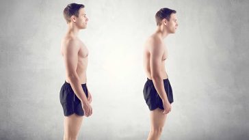 Poor Posture